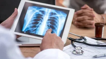 Las personas con asma y enfermedad pulmonar obstructiva crónica pueden ver agravados sus síntomas a causa de factores ambientales