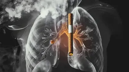 Las líneas de teléfono gratuitas y otras intervenciones pueden ayudar a dejar de fumar (Imagen Ilustrativa Infobae)